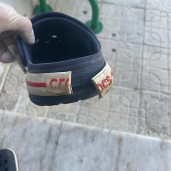 Crocs Terlik & Ayakkabı Crocs'ta Yırtılma Ve Garanti