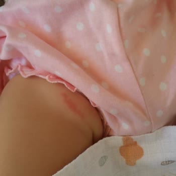 Sleepy 4 Numara Bebek Bezi Şikayeti