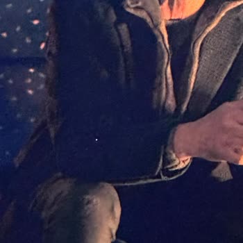 Philips TV Philips Ambilight Ölü Pixel 5-6 Ya Kadar Normal Denilmesi