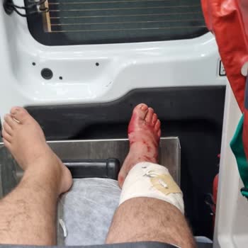 Notion Kesre Beach Hotel Fayansları Ayağımı Kesti