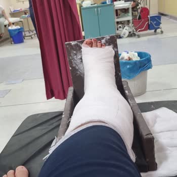 Notion Kesre Beach Hotel Fayansları Ayağımı Kesti