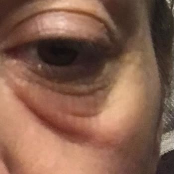 Garnier C Vitamini Serumu Gözümü Balon Etti