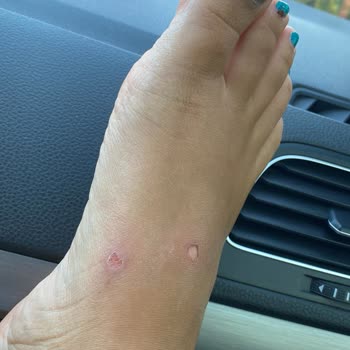 Greyder Terlik Ayak Sağlığımızı Bozdu