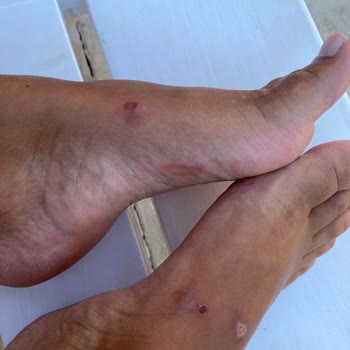 Greyder Terlik Ayak Sağlığımızı Bozdu