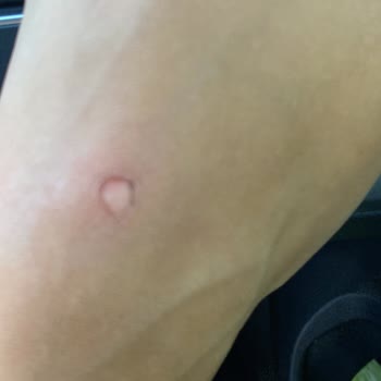 Greyder Terlik Ayak Sağlığımızı Bozdu