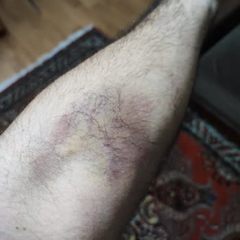 Özel Avrupa Tıp Merkezi (İzmir) Mağdur Oldum