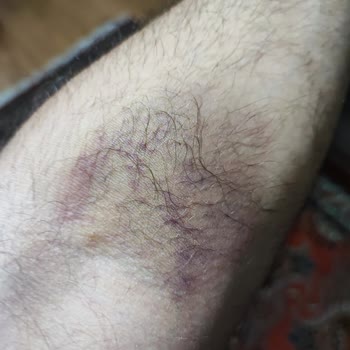 Özel Avrupa Tıp Merkezi (İzmir) Mağdur Oldum