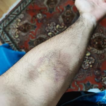 Özel Avrupa Tıp Merkezi (İzmir) Mağdur Oldum