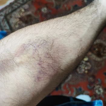 Özel Avrupa Tıp Merkezi (İzmir) Mağdur Oldum