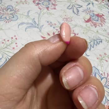 Deniz Kalender Güzellik&Epilasyon'dan Şikayetçiyim