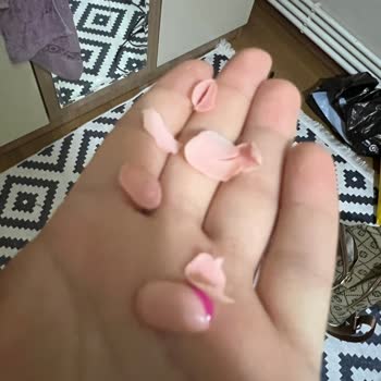 Deniz Kalender Güzellik&Epilasyon'dan Şikayetçiyim