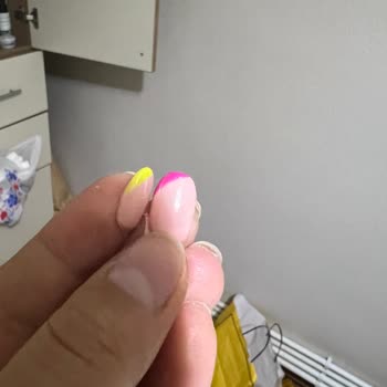 Deniz Kalender Güzellik&Epilasyon'dan Şikayetçiyim