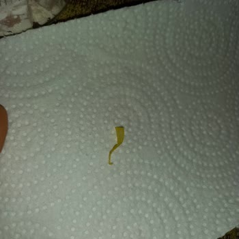 Ogaş Şekerleme Ürün İçerisinden Plastik Çıkması