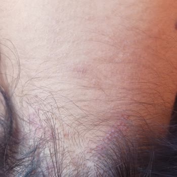 Kokoş Kuaför Afrika Örgüsü Yaptırdım Mağdur Oldum