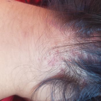 Kokoş Kuaför Afrika Örgüsü Yaptırdım Mağdur Oldum