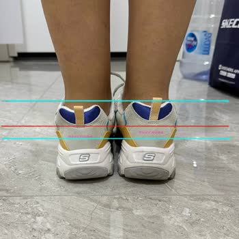 Skechers Üretim Hatasını Kabul Etmiyor