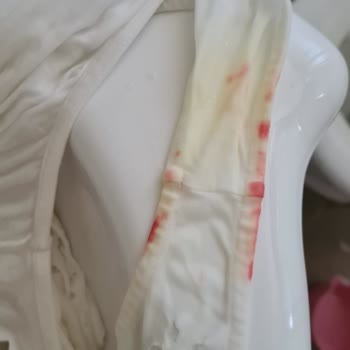 Domestos Çamaşır Suyu Beyaz Kıyafetime Kırmızı Leke Yaptı