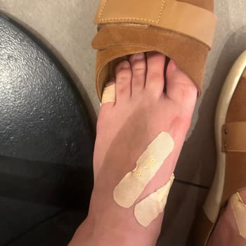 Elle Ayakkabı Elle Terlik Ayağımı Yara Yaptı