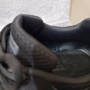 Skechers Ayakkabı Deforme Olması