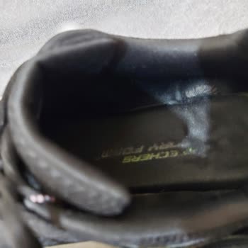 Skechers Ayakkabı Deforme Olması