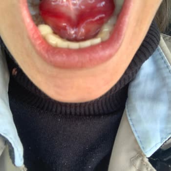 Atamer Ağız Ve Diş Sağlığı Polikliniği (İstanbul) Diş Tedavim İçin Gittim Ölümden Döndüm