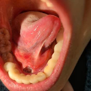 Atamer Ağız Ve Diş Sağlığı Polikliniği (İstanbul) Diş Tedavim İçin Gittim Ölümden Döndüm