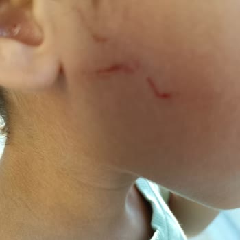 YKM Sizin İçin Bir Çocuğun Sağlığının Değeri Nedir YKM?