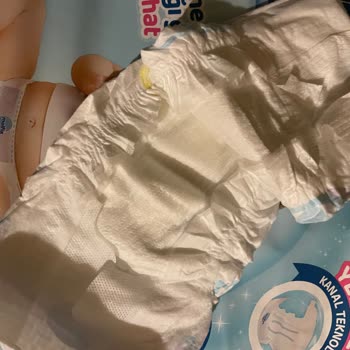 BİM'de Satılan Molfix Bez Kalitesi Başka!