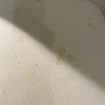 Booking.com Alerji Yapan Oda!