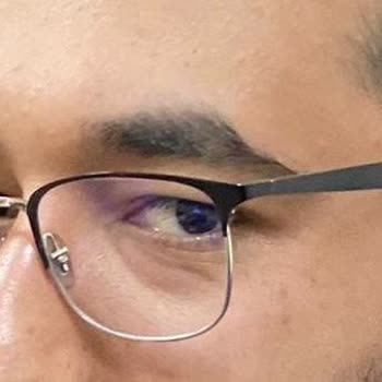 Atasun Optik Farklı Gözlük Gönderdiler