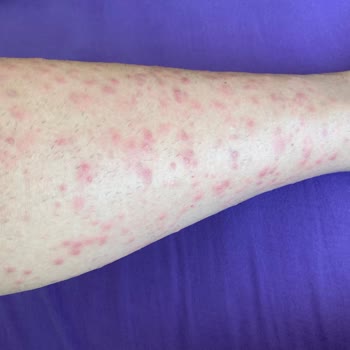 Veet Tüy Dökücü Kremin Cildimdeki Etkisi