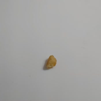 Kahve Dünyası Lavi Çikolatanın İçinden Yabancı Cisim Çıktı!