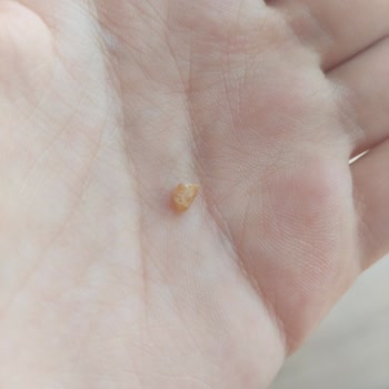 Kahve Dünyası Lavi Çikolatanın İçinden Yabancı Cisim Çıktı!