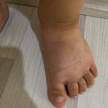Zara Kullanıma Uygun Olmayan Sandalet