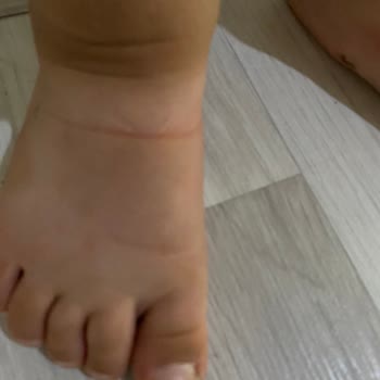 Zara Kullanıma Uygun Olmayan Sandalet