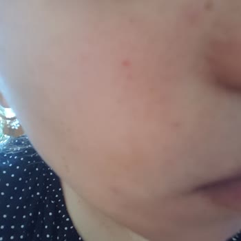 Garnier Yuz Temizleme Jeli