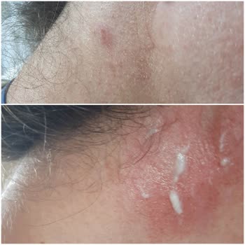 Loreal Paris Saç Boyası Derimi Yaktı