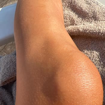 The Beauty Lounge Miray & Melis Lazer Diod