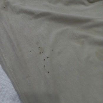 Maviden Aldığım Kot Pantolonun Düğmesi Tüm Tshirtlerimi Deldi