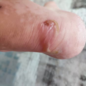 FLO Ayakkabı Ayakkabı Değişimi İstiyorum