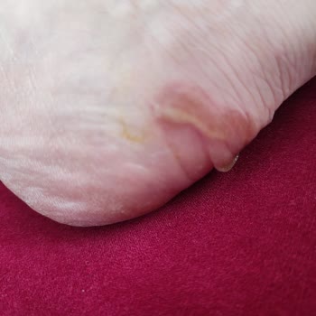 FLO Ayakkabı Ayakkabı Değişimi İstiyorum