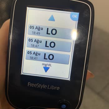 Freestyle Libre Bozuldu Önce Hata Verdi Sonra Değiştirin Dedi