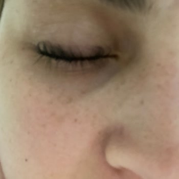 Selin Beauty Center Güzellik Merkezi Kirpik Lifting Mağduriyeti