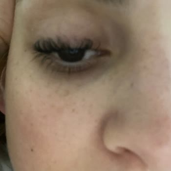 Selin Beauty Center Güzellik Merkezi Kirpik Lifting Mağduriyeti