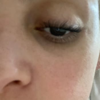 Selin Beauty Center Güzellik Merkezi Kirpik Lifting Mağduriyeti