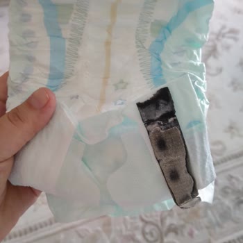 Molfix İçinden Bilinmedik Çürümüş Ürün Çıktı!