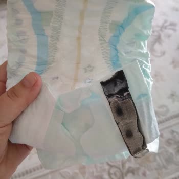 Molfix İçinden Bilinmedik Çürümüş Ürün Çıktı!