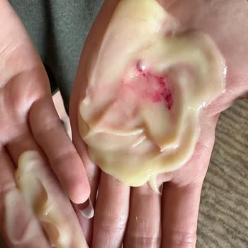 Bee Beauty Gratis'ten Aldığım Ürünün İçerinde Lekeler Var