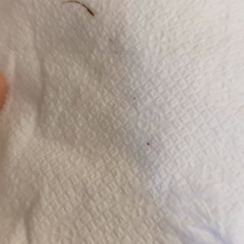 Nutella Kutusundan Kıl Çıktı