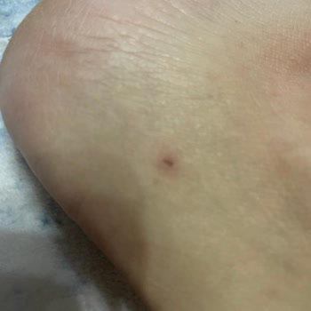 Hotiç Ayakkabı İçinde Farklı Madde Var Hatalı Çıktı